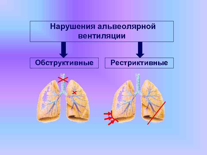 Нарушения альвеолярной вентиляции Обструктивные Рестриктивные 