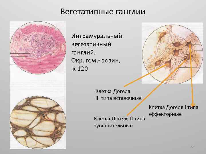 Вегетативные ганглии Интрамуральный вегетативный ганглий. Окр. гем. - эозин, х 120 Клетка Догеля III