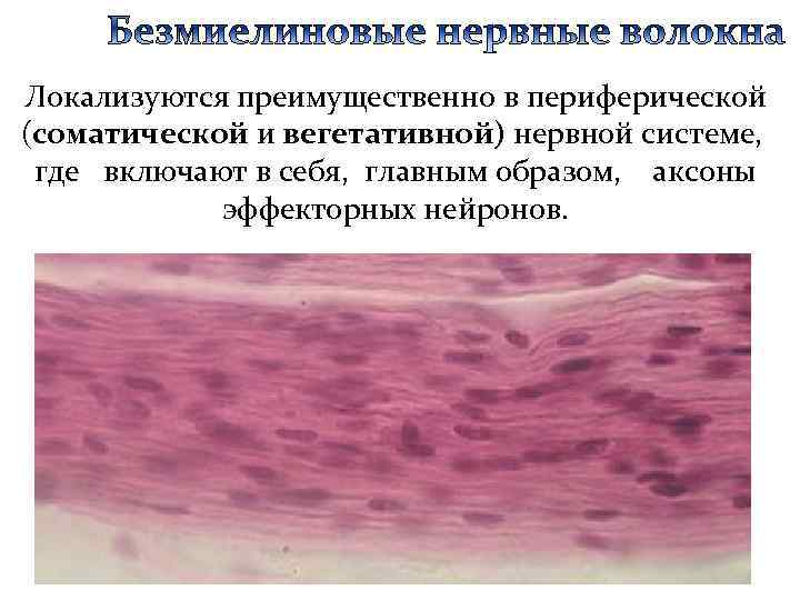 Локализуются преимущественно в периферической (соматической и вегетативной) нервной системе, где включают в себя, главным