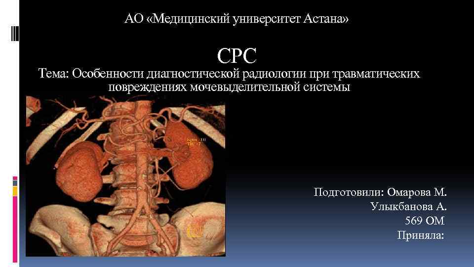 АО «Медицинский университет Астана» СРС Тема: Особенности диагностической радиологии при травматических повреждениях мочевыделительной системы