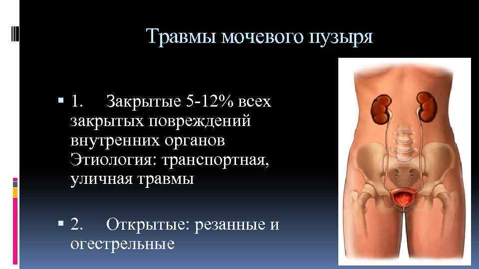 Травмы мочевого пузыря 1. Закрытые 5 -12% всех закрытых повреждений внутренних органов Этиология: транспортная,