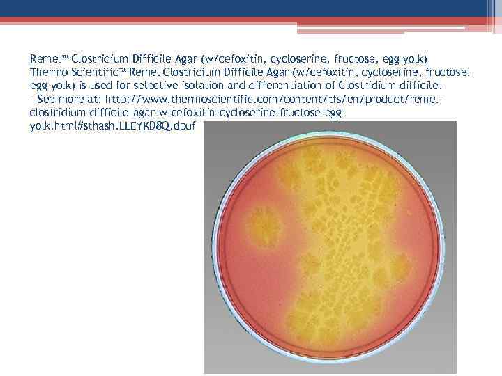 Remel™ Clostridium Difficile Agar (w/cefoxitin, cycloserine, fructose, egg yolk) Thermo Scientific™ Remel Clostridium Difficile