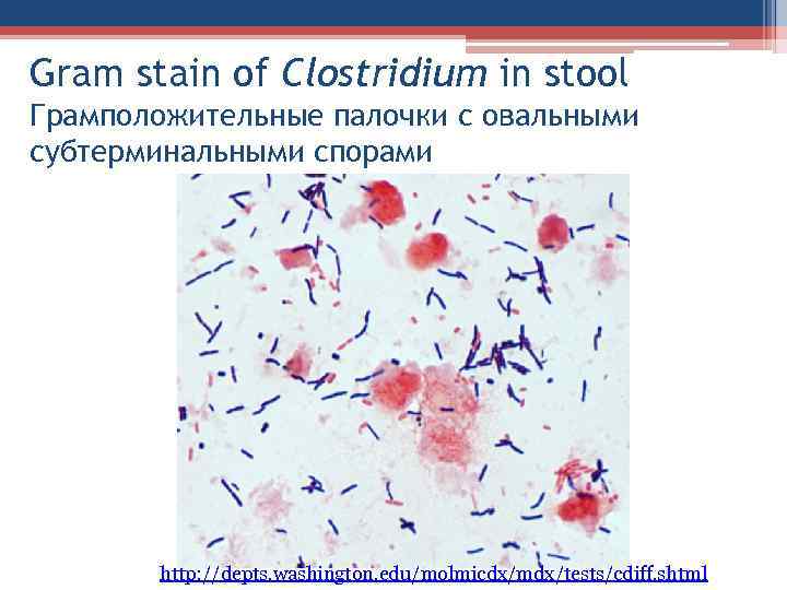 Gram stain of Clostridium in stool Грамположительные палочки с овальными субтерминальными спорами http: //depts.