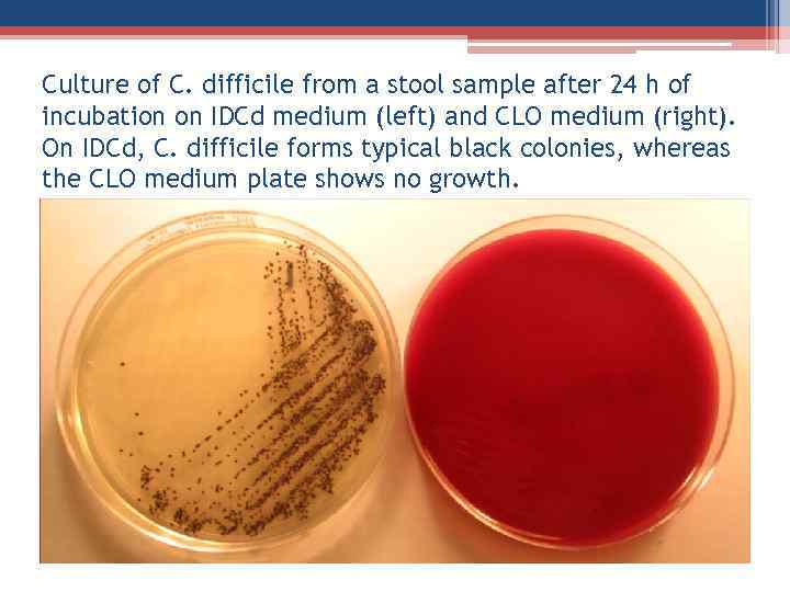 Culture of C. difficile from a stool sample after 24 h of incubation on