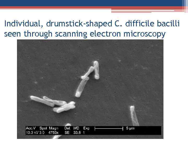 Individual, drumstick-shaped C. difficile bacilli seen through scanning electron microscopy 