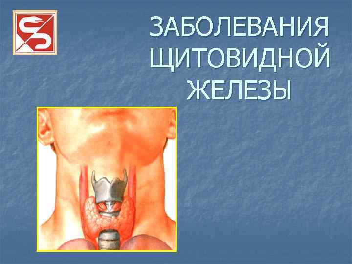 ЗАБОЛЕВАНИЯ ЩИТОВИДНОЙ ЖЕЛЕЗЫ 