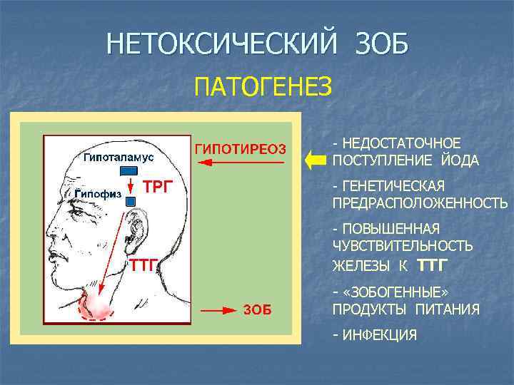 НЕТОКСИЧЕСКИЙ ЗОБ ПАТОГЕНЕЗ - НЕДОСТАТОЧНОЕ ПОСТУПЛЕНИЕ ЙОДА - ГЕНЕТИЧЕСКАЯ ПРЕДРАСПОЛОЖЕННОСТЬ - ПОВЫШЕННАЯ ЧУВСТВИТЕЛЬНОСТЬ ЖЕЛЕЗЫ