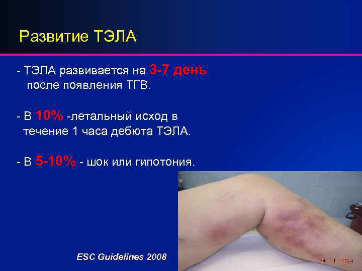 Развитие ТЭЛА - ТЭЛА развивается на 3 -7 день после появления ТГВ. - В