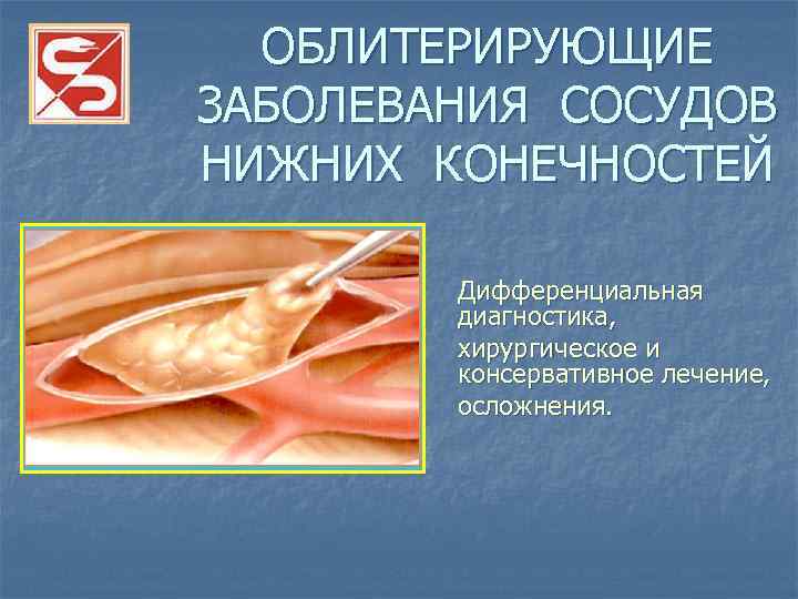 ОБЛИТЕРИРУЮЩИЕ ЗАБОЛЕВАНИЯ СОСУДОВ НИЖНИХ КОНЕЧНОСТЕЙ Дифференциальная диагностика, хирургическое и консервативное лечение, осложнения. 