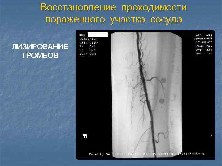 Постнатальные изменения в сосудистой стенке