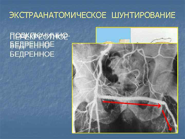 Заболевание сосудов нижних конечностей фото