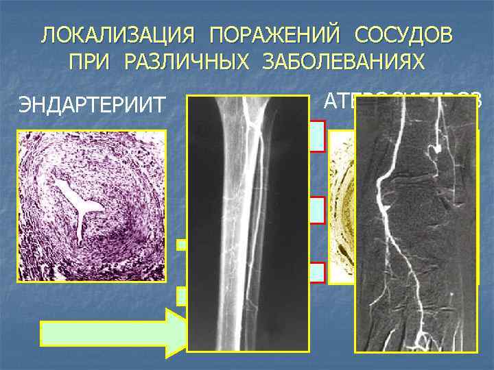 Заболевание сосудов нижних конечностей фото