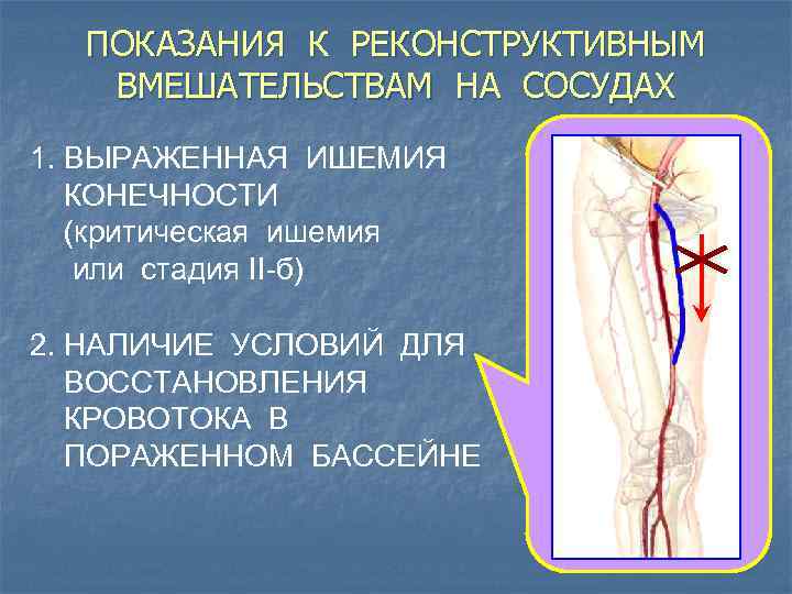 ПОКАЗАНИЯ К РЕКОНСТРУКТИВНЫМ ВМЕШАТЕЛЬСТВАМ НА СОСУДАХ 1. ВЫРАЖЕННАЯ ИШЕМИЯ КОНЕЧНОСТИ (критическая ишемия или стадия