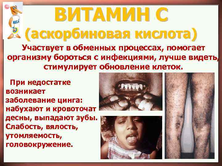 ВИТАМИН С (аскорбиновая кислота) Участвует в обменных процессах, помогает организму бороться с инфекциями, лучше