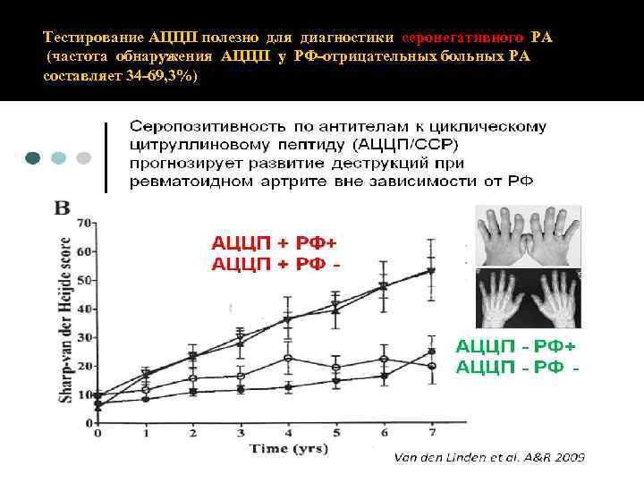  Тестирование АЦЦП полезно для диагностики серонегативного РА (частота обнаружения АЦЦП у РФ‐отрицательных больных