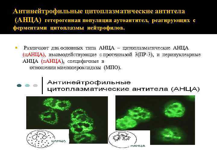 Антинейтрофильные цитоплазматические антитела (АНЦА) гетерогенная популяция аутоантител, реагирующих с ферментами цитоплазмы нейтрофилов. Различают два