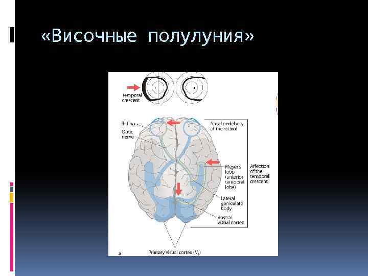  «Височные полулуния» 