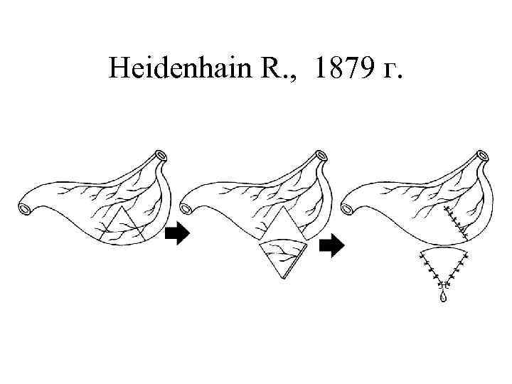 Heidenhain R. , 1879 г. 