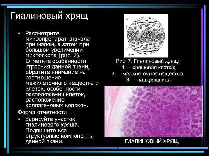 Гиалиновый хрящ • Рассмотрите микропрепарат сначала при малом, а затем при большом увеличении микроскопа