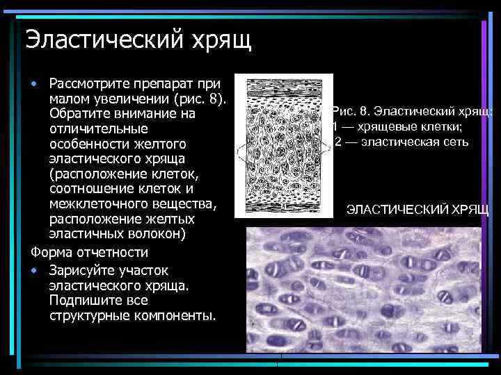 Эластический хрящ • Рассмотрите препарат при малом увеличении (рис. 8). Обратите внимание на отличительные