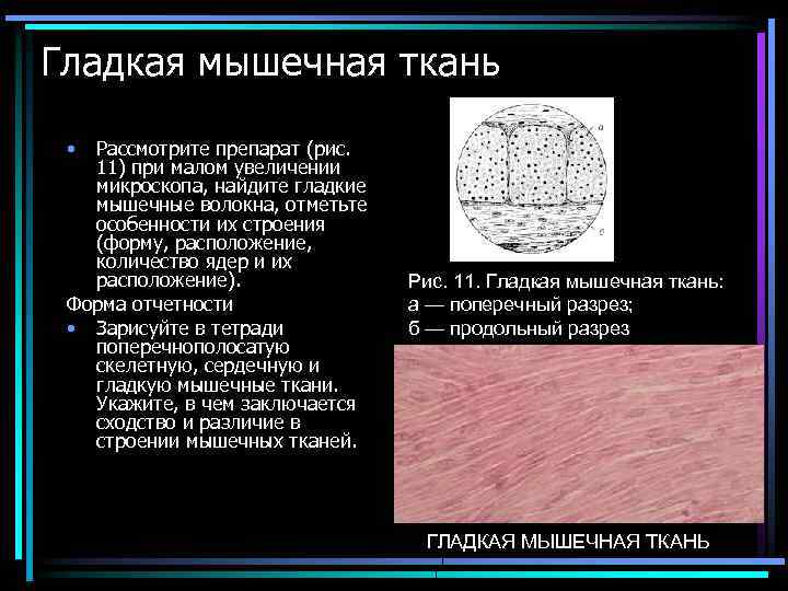 Гладкая мышечная ткань • Рассмотрите препарат (рис. 11) при малом увеличении микроскопа, найдите гладкие