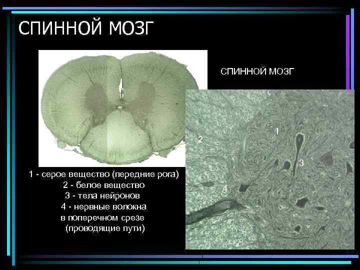 СПИННОЙ МОЗГ 1 2 3 1 - серое вещество (передние рога) 2 - белое