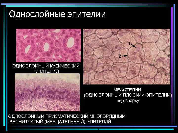 Однослойные эпителии ОДНОСЛОЙНЫЙ КУБИЧЕСКИЙ ЭПИТЕЛИЙ МЕЗОТЕЛИЙ (ОДНОСЛОЙНЫЙ ПЛОСКИЙ ЭПИТЕЛИЙ) вид сверху ОДНОСЛОЙНЫЙ ПРИЗМАТИЧЕСКИЙ МНОГОРЯДНЫЙ