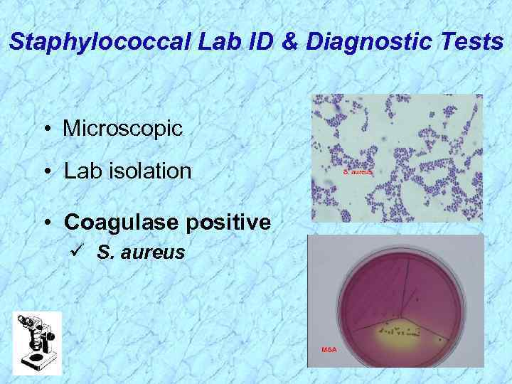 Staphylococcal Lab ID & Diagnostic Tests • Microscopic • Lab isolation • Coagulase positive