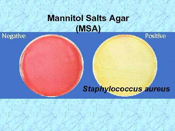 Mannitol Salts Agar (MSA) Staphylococcus aureus 