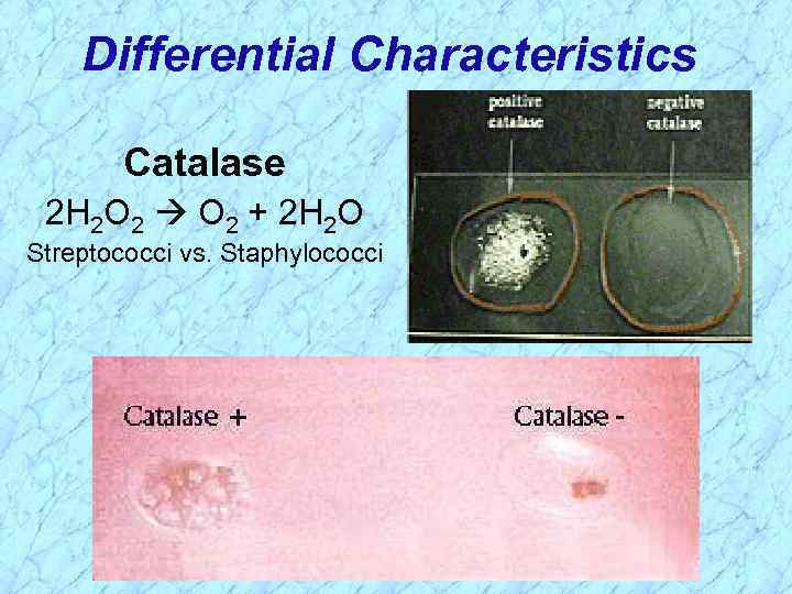 Differential Characteristics Catalase 2 H 2 O 2 + 2 H 2 O Streptococci