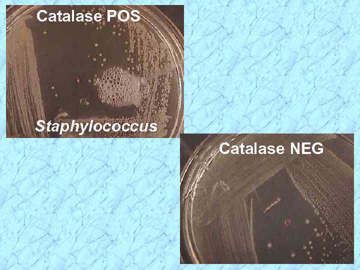 Catalase POS Staphylococcus Catalase NEG 