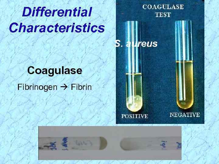 Differential Characteristics S. aureus Coagulase Fibrinogen Fibrin 