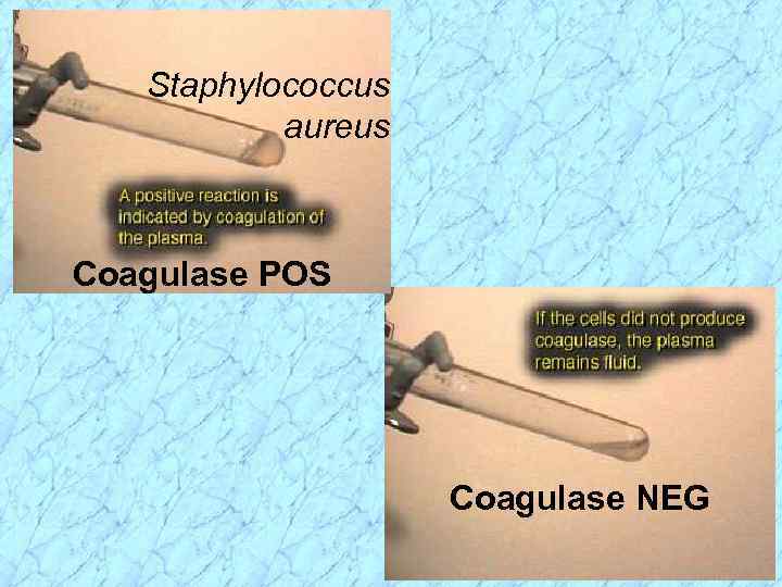 Staphylococcus aureus Coagulase POS Coagulase NEG 