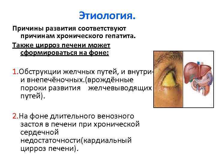 Этиология. Причины развития соответствуют причинам хронического гепатита. Также цирроз печени может сформироваться на фоне:
