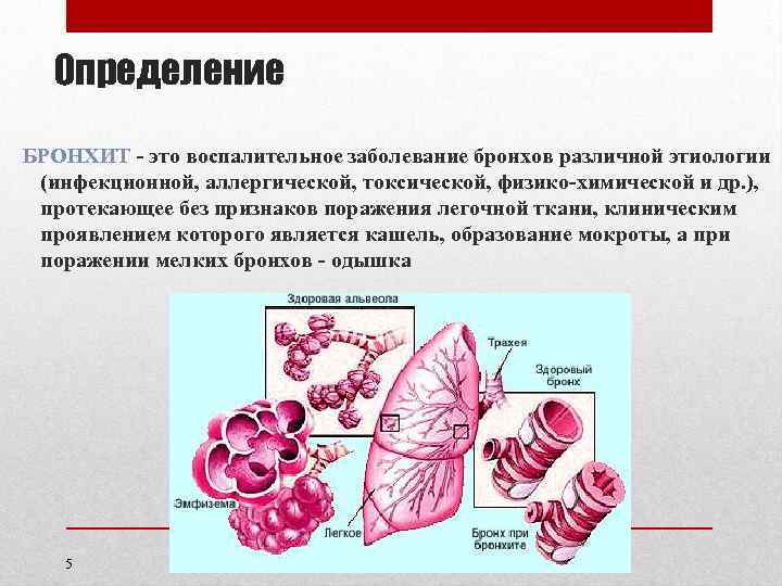 Определение БРОНХИТ - это воспалительное заболевание бронхов различной этиологии (инфекционной, аллергической, токсической, физико-химической и