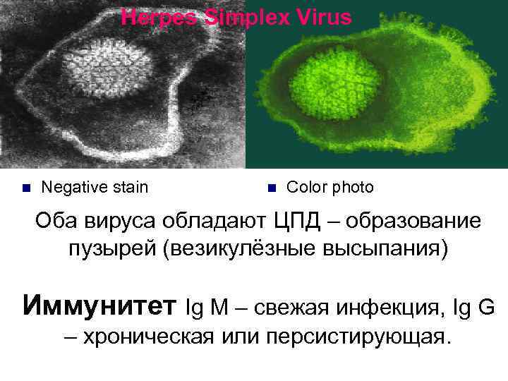 Herpes Simplex Virus n Negative stain n Color photo Оба вируса обладают ЦПД –