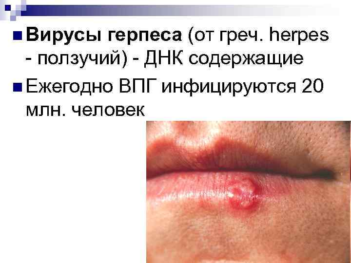 n Вирусы герпеса (от греч. herpes - ползучий) - ДНК содержащие n Ежегодно ВПГ