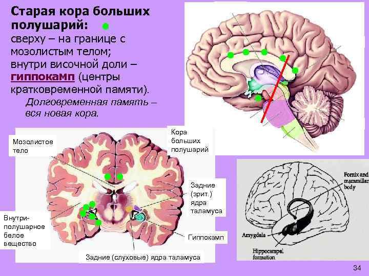 Старая кора больших полушарий: Таламус сверху – на границе с мозолистым телом; внутри височной