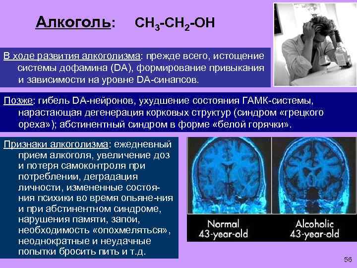 Алкоголь: СН 3 -СН 2 -ОН В ходе развития алкоголизма: прежде всего, истощение системы