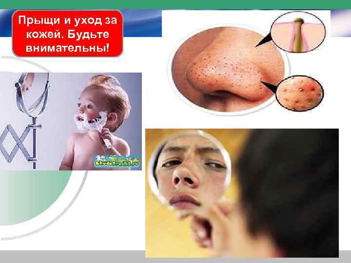Прыщи и уход за кожей. Будьте внимательны! 