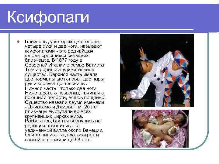 Ксифопаги l Близнецы, у которых две головы, четыре руки и две ноги, называют ксифопагами