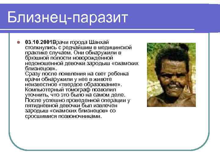 Близнец-паразит l 03. 10. 2001 Врачи города Шанхай столкнулись с редчайшим в медицинской практике