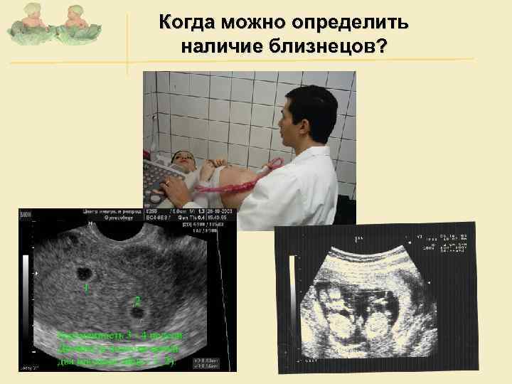 Когда можно определить наличие близнецов? 