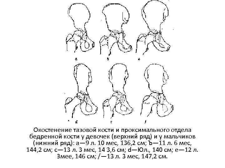 Окостенение головки бедренной кости. Кости таза новорожденного. Окостенение тазовой кости. Возрастные особенности таза. Развитие костей таза.