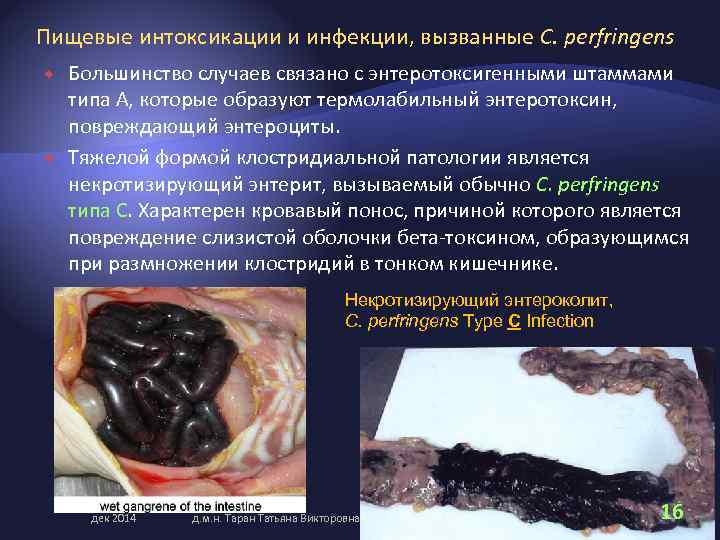 Пищевые интоксикации и инфекции, вызванные C. perfringens Большинство случаев связано с энтеротоксигенными штаммами типа