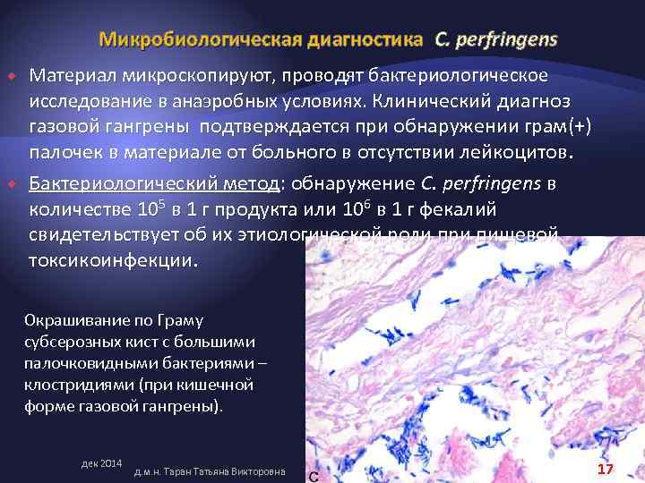 Микробиологическая диагностика C. perfringens Материал микроскопируют, проводят бактериологическое исследование в анаэробных условиях. Клинический диагноз