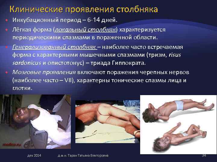 Клинические проявления столбняка Инкубационный период – 6 14 дней. Лёгкая форма (локальный столбняк) характеризуется