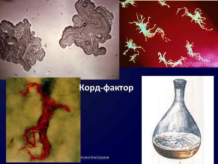 Корд-фактор нояб 2014 д. м. н. Таран Татьяна Викторовна 11 