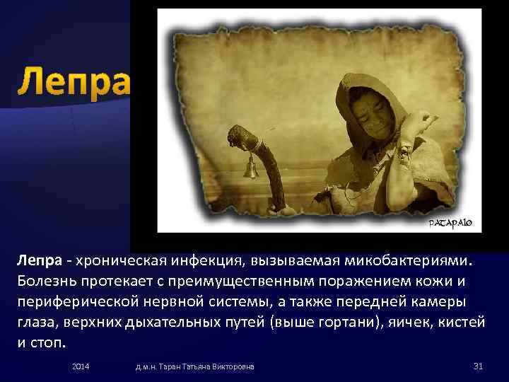 Лепра - хроническая инфекция, вызываемая микобактериями. Болезнь протекает с преимущественным поражением кожи и периферической