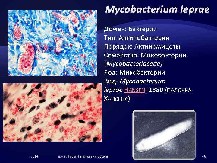 Mycobacterium leprae Домен: Бактерии Тип: Актинобактерии Порядок: Актиномицеты Семейство: Микобактерии (Mycobacteriaceae) Род: Микобактерии Вид: